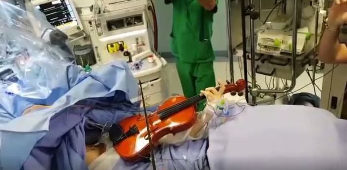 Operata al cervello a Taranto mentre suona il violino